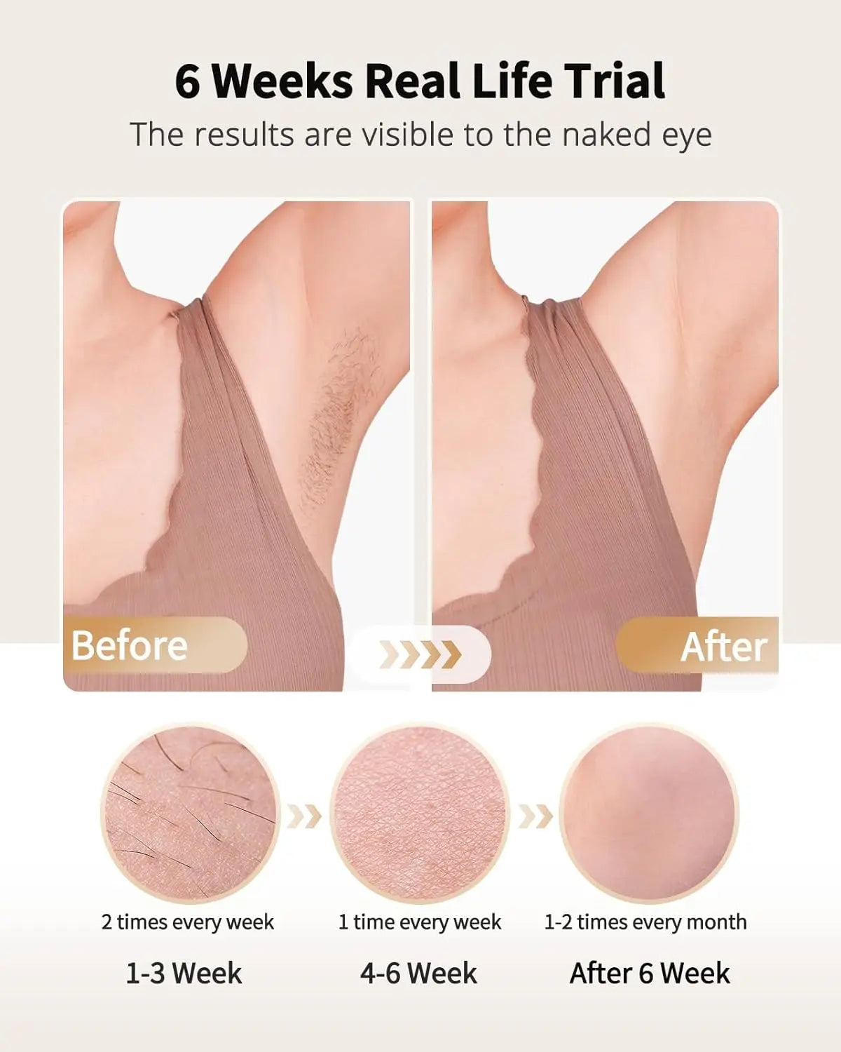 IPL Hair Removal with Ice Cooling Care Function for Women Men Permanent,Unlimited Flashes Painless Epilator IPL Hair Remover